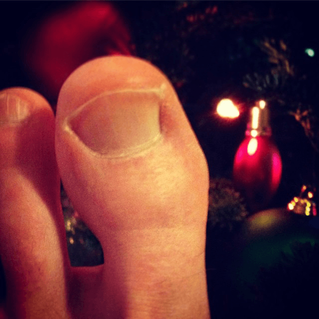 merry christmas from my big toe to yours