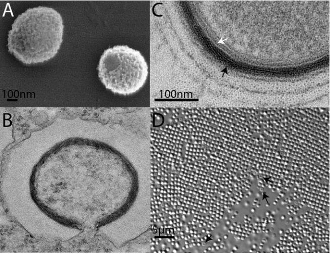 Frankenvirus emerges from Siberia's frozen wasteland