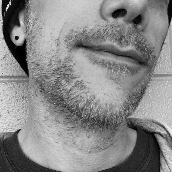 The beginnings of the beard